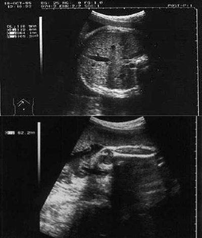 УЗИ на 34 неделе беременности: показатели нормы у плода и будущей матери