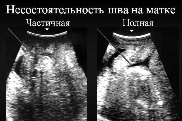 УЗИ на 34 неделе беременности: показатели нормы у плода и будущей матери