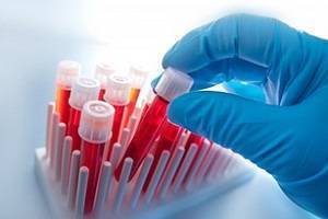 Гематокрит понижен при беременности: причины, нормы в разных триместрах