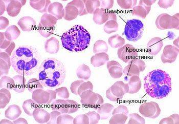 Повышены моноциты у ребенка в крови: причины отклонений от нормы