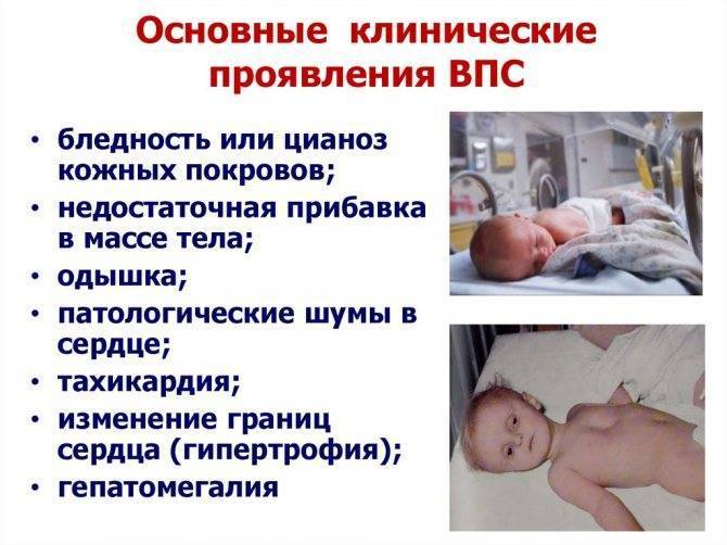 Причины врожденных пороков сердца у детей, симптомы и лечение, последствия