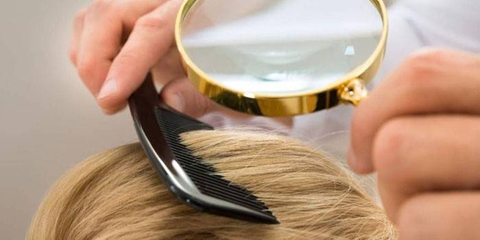 Как вывести вшей в волосах у ребенка: симптомы педикулеза с фото и лечение в домашних условиях