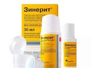 Сыпь у ребенка на попе - фото прыщей с пояснениями, причины аллергии и сухой кожи, лечение