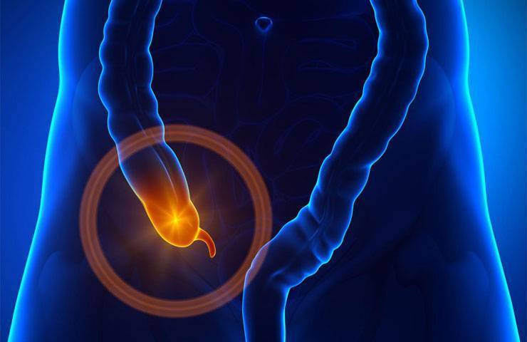 Почему болит низ живота как при месячных, но их нет, в каких случаях стоит волноваться?