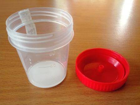 Как алкоголь влияет на спермограмму и состояние сперматозоидов, стоит ли выпивать перед процедурой?