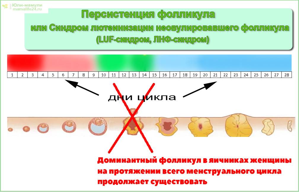 Понятие и особенности персистенции желтого тела, диагностика и лечение патологии