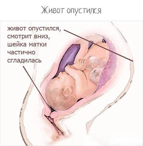 Как понять, что опустился живот перед родами: на какой неделе происходит опущение, когда рожать?