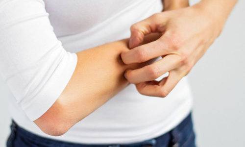 Осложнения после ветрянки у детей - какие могут быть последствия перенесенной оспы?