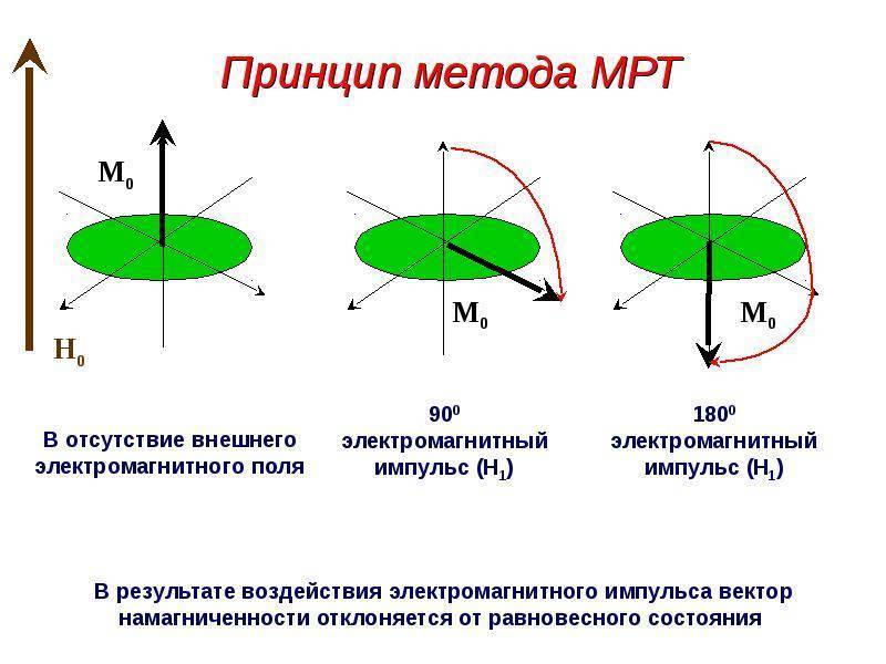 Можно ли делать МРТ беременным на ранних и поздних сроках: томография головного мозга, позвоночника