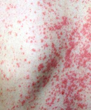 Четвертая беременность: особенности ее течения, как проходят роды