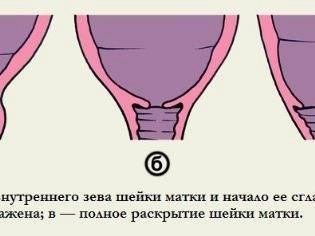 Почему роды начинаются ночью, в какое время суток обычно чаще всего бывают схватки?