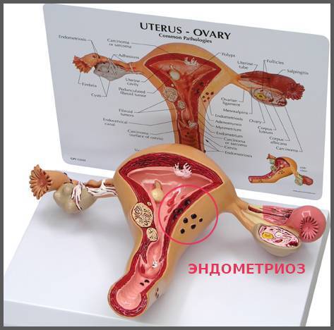 Неприятные ощущения внизу живота у женщин: о чем они говорят, как от них избавиться?