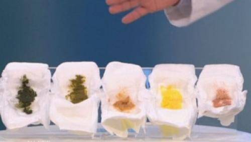 Белые комочки в кале у грудничка при грудном вскармливании: причины белого стула