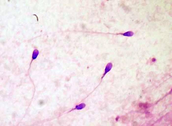 Как алкоголь влияет на спермограмму и состояние сперматозоидов, стоит ли выпивать перед процедурой?