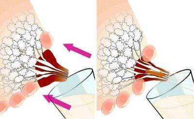 Грудное вскармливание после кесарева сечения: когда приходит молоко?