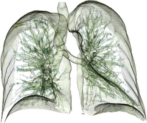 Реакция Манту у детей: норма размеров по возрасту в 1-3 года с фото