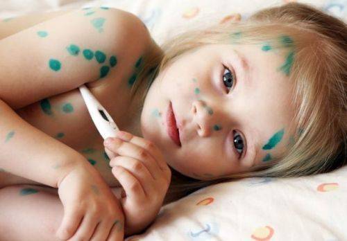 Герпес у детей: виды вируса, симптомы заболеваний, лечение и профилактика