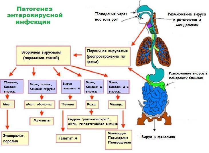 Вирус Коксаки у детей: фото, симптомы в инкубационный период, лечение
