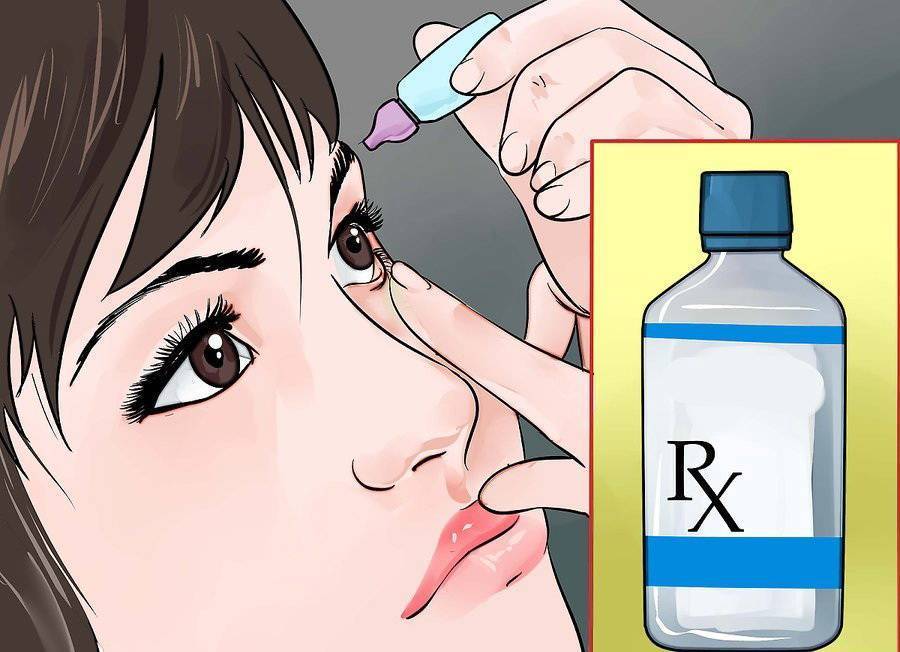 Склеропластика глаз у детей - что это такое, какие есть "за" и "против" для операции?