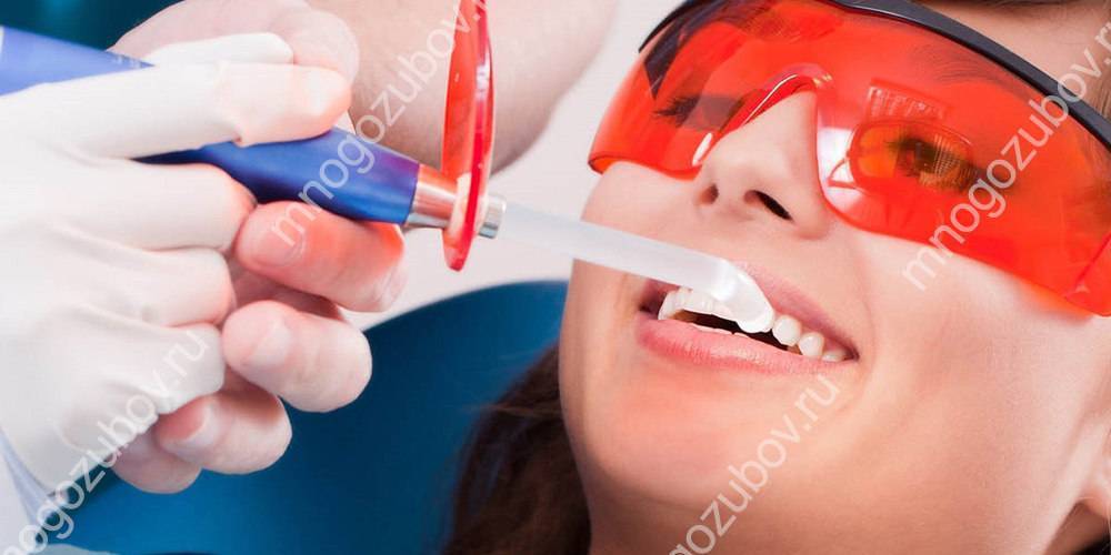 Черный налет на зубах у детей: причины, фото, способы убрать пятна