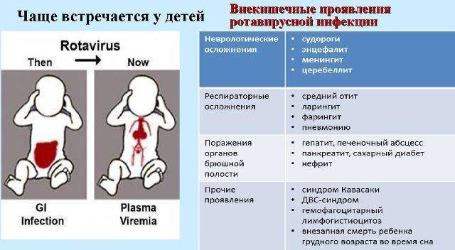 Ротавирус у грудничка: симптомы инфекции у новорожденных и лечение