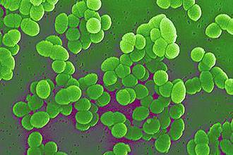 Бактериальная ангина у детей: симптомы и лечение, профилактика болезни