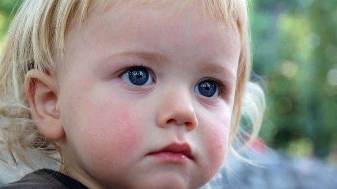 Пеленочный дерматит у детей: симптомы с фото и лечение по Комаровскому