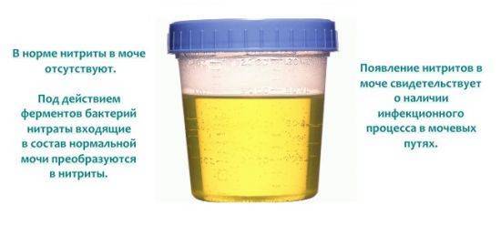 Нитриты в моче у ребенка - что это значит, каковы причины патологии и нужно ли ее лечить?
