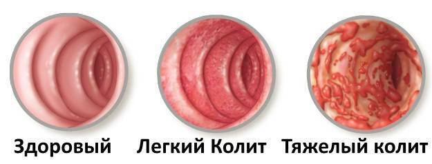 У ребенка болит живот и рвота без температуры: что делать, как помочь малышу?