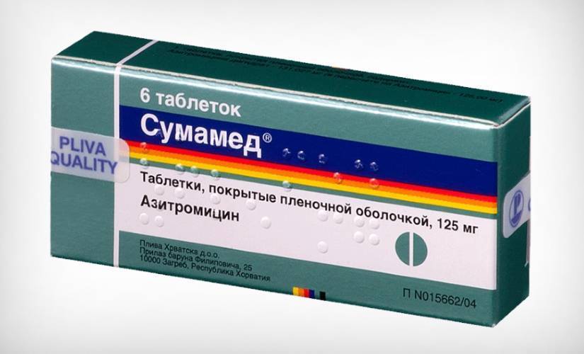 Ларингит у детей: симптомы и лечение в домашних условиях (список препаратов и антибиотиков)