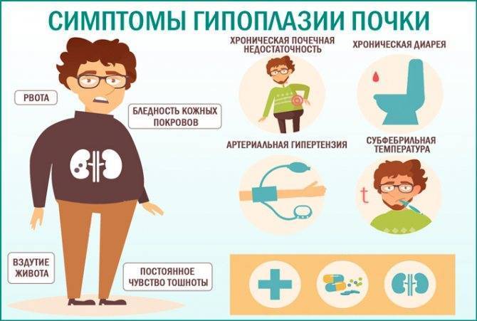 Гипоплазия почки у ребенка: причины, симптомы и лечение