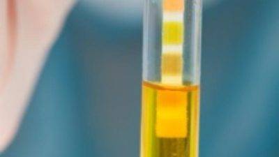 Нитриты в моче у ребенка - что это значит, каковы причины патологии и нужно ли ее лечить?