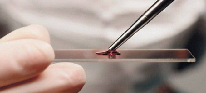 Эозинофилы у ребенка повышены или понижены: нормы крови, причины отклонений