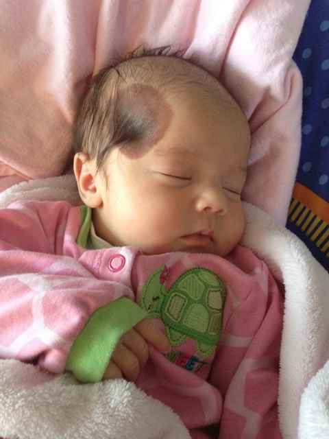 Пигментные пятна у детей - фото, причины и лечение