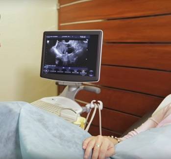 Искусственная инсеминация в домашних условиях: подготовка женщины к процедуре, правила ее выполнения