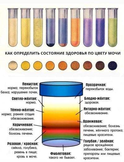 Нитриты в моче у ребенка - что это значит, каковы причины патологии и нужно ли ее лечить?