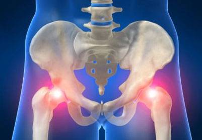 Воспаление тазобедренного сустава у ребенка - симптомы, причины и лечение артрита