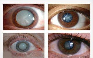 Энтеросгель: инструкция по применению для детей до года и старше при ротавирусе и рвоте, аналоги