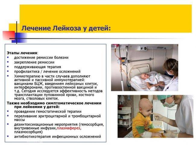 Лейкоз: симптомы у детей, признаки лейкемии в острой стадии, анализы и лечение