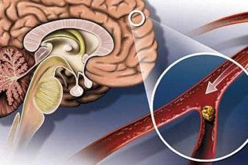Повышена щелочная фосфатаза в крови у ребенка: что это значит и каковы нормы показателя