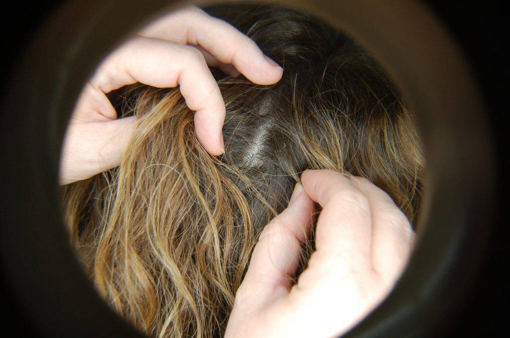 Шишка на голове у ребенка - что это может быть?