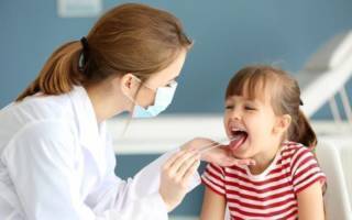 Красные точки во рту у ребенка - сыпь на слизистой неба и горла: фото с пояснениями