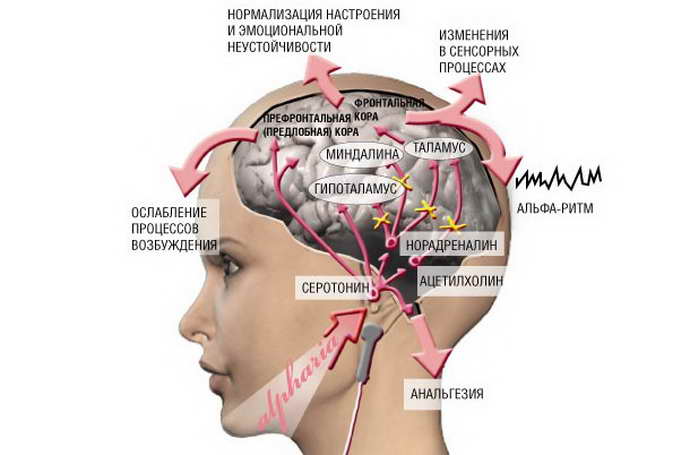 Микрополяризация головного мозга детям: показания и противопоказания курса ТКМП