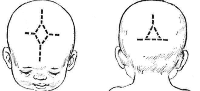 Родничок у новорожденных: когда зарастает темечко - нормы по месяцам