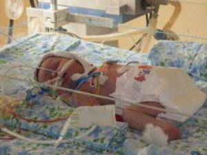 Гипотрофия у детей раннего возраста: 1, 2 и 3 степени (лечение, профилактика)