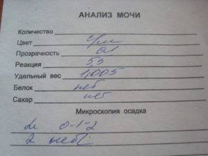 Как определить по моче беременность, покажет ли общий анализ ее наличие?
