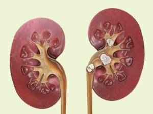 Ребенку больно писать: девочка и мальчик плачет перед мочеиспусканием