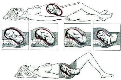 Как понять, что опустился живот перед родами: на какой неделе происходит опущение, когда рожать?