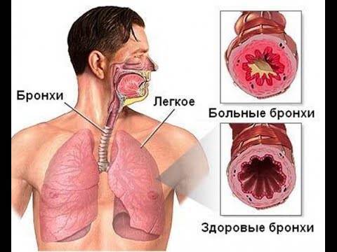 Как лечить горловой кашель у ребенка: медикаменты и народные средства