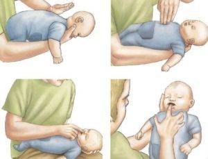 Что делать, если ребенок подавился и задыхается: первая помощь